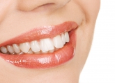 Estetica Dentara Estetica Dentara