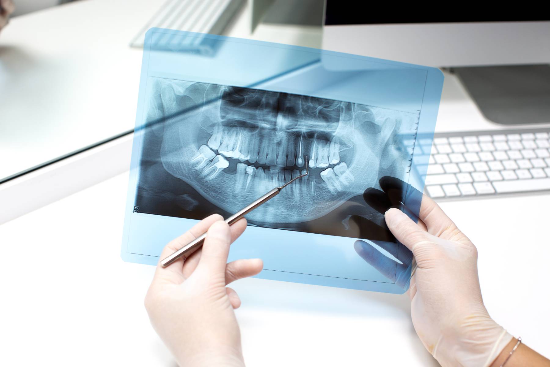 dentist analizeaza radiografia