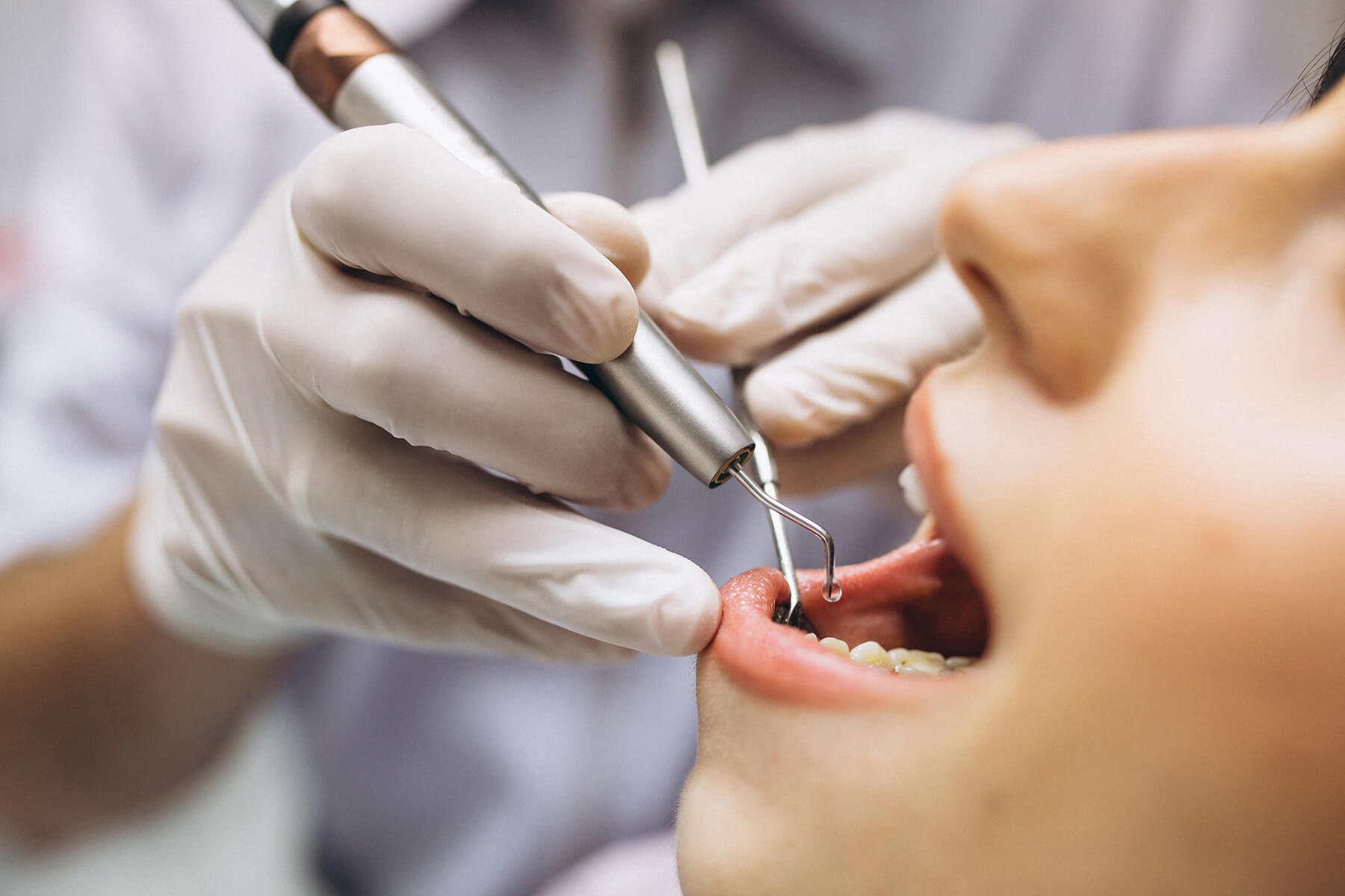 vedere din față a conceptului de proteză dentară completă