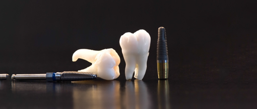 IMPLANUL DENTAR- BENEFICII ESTETICE SI FUNCTIONALE- INTERVIU TONICA TV