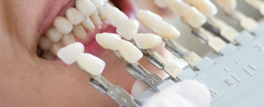 FATETE DENTARE- SOLUTIA PENTRU ZAMBETUL MULT DORIT